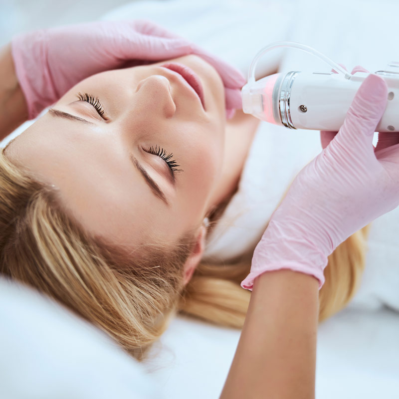 Cosmetic Services - Microneedling